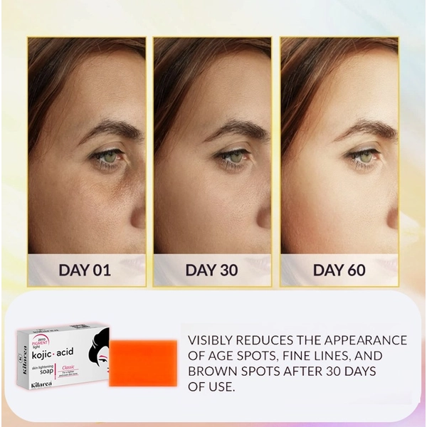 Kilarca Kojic Acid Skin Lightening Soap – Quick Whitening & Pigmentation Removal (120g)